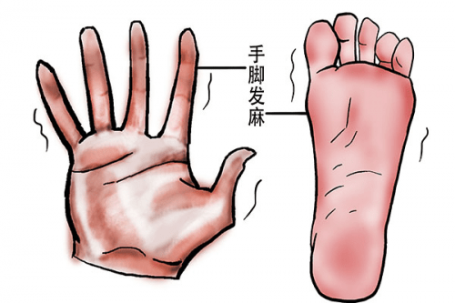 手腳經(jīng)常發(fā)麻是什么原因?手腳發(fā)麻可能患有哪些疾?。? /></span></p><p style=